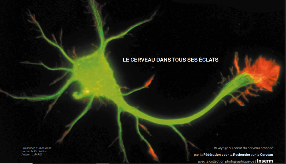 Exposition sur le Cerveau